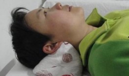 三叉神经痛可以吃瓜吗,瓜类食物的食用指南